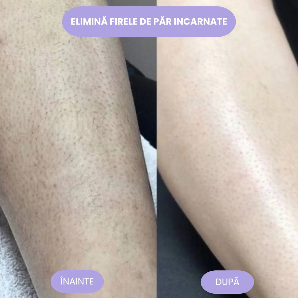 Vesta Crystal Hair Eraser