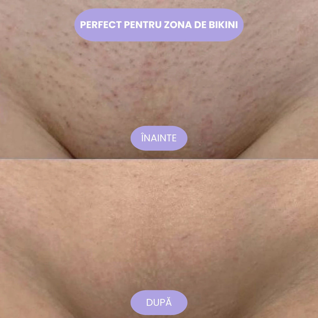 Vesta Crystal Hair Eraser