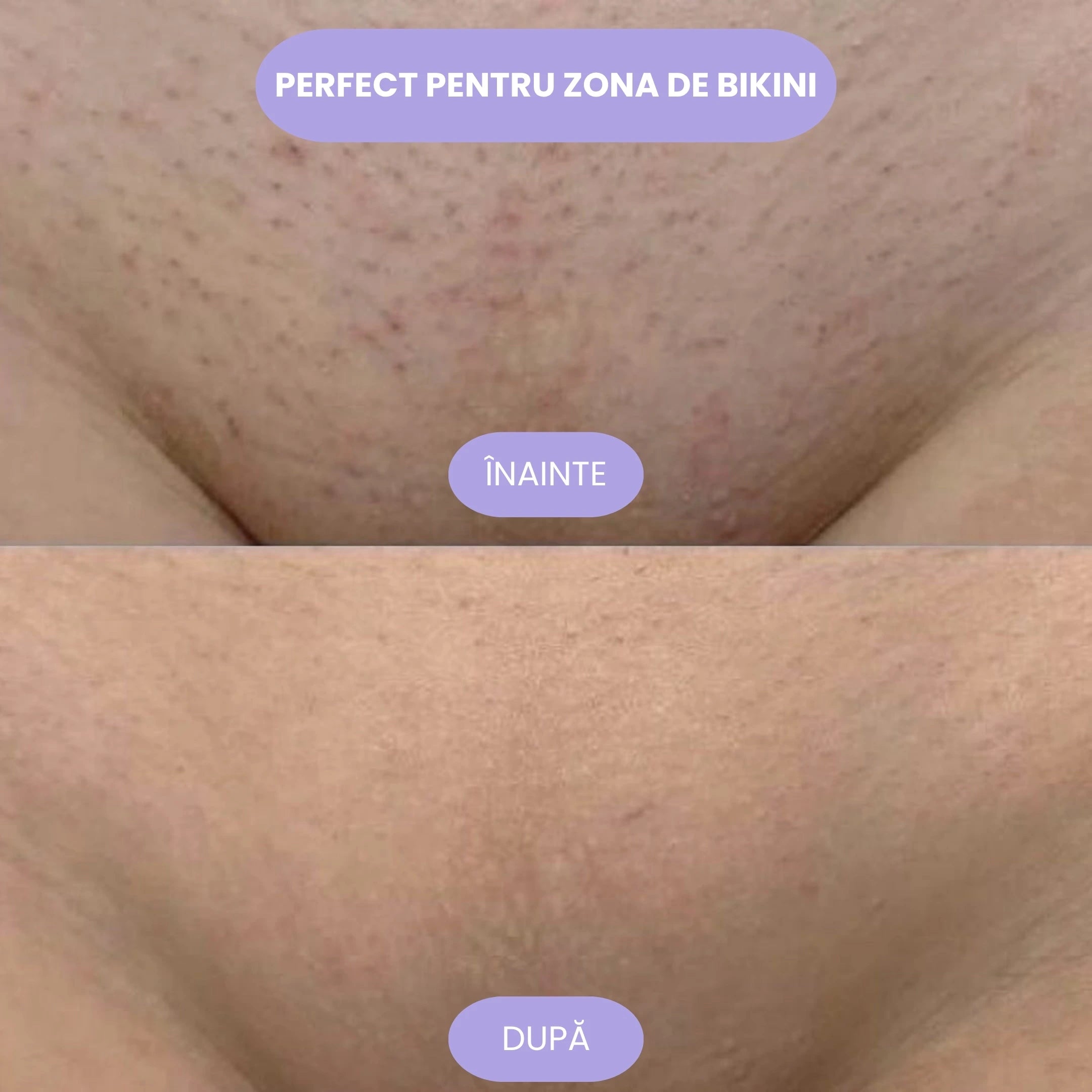 Vesta Crystal Hair Eraser